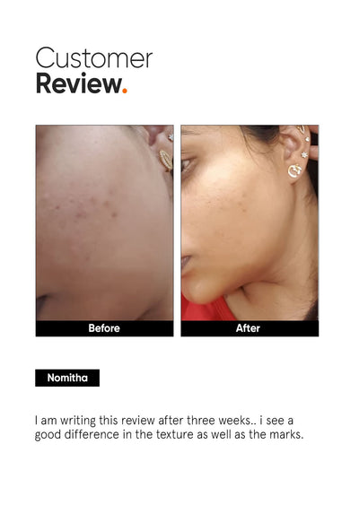 Minimalist AHA PHA BHA 32% Face Peel