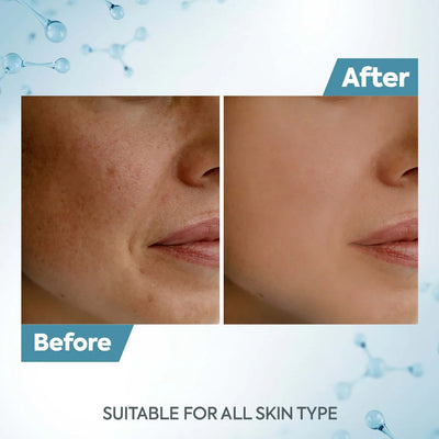 Raaga Professional De-Tan Pack | Tan Removal Cream with Kojic Acid & Milk (500gm)