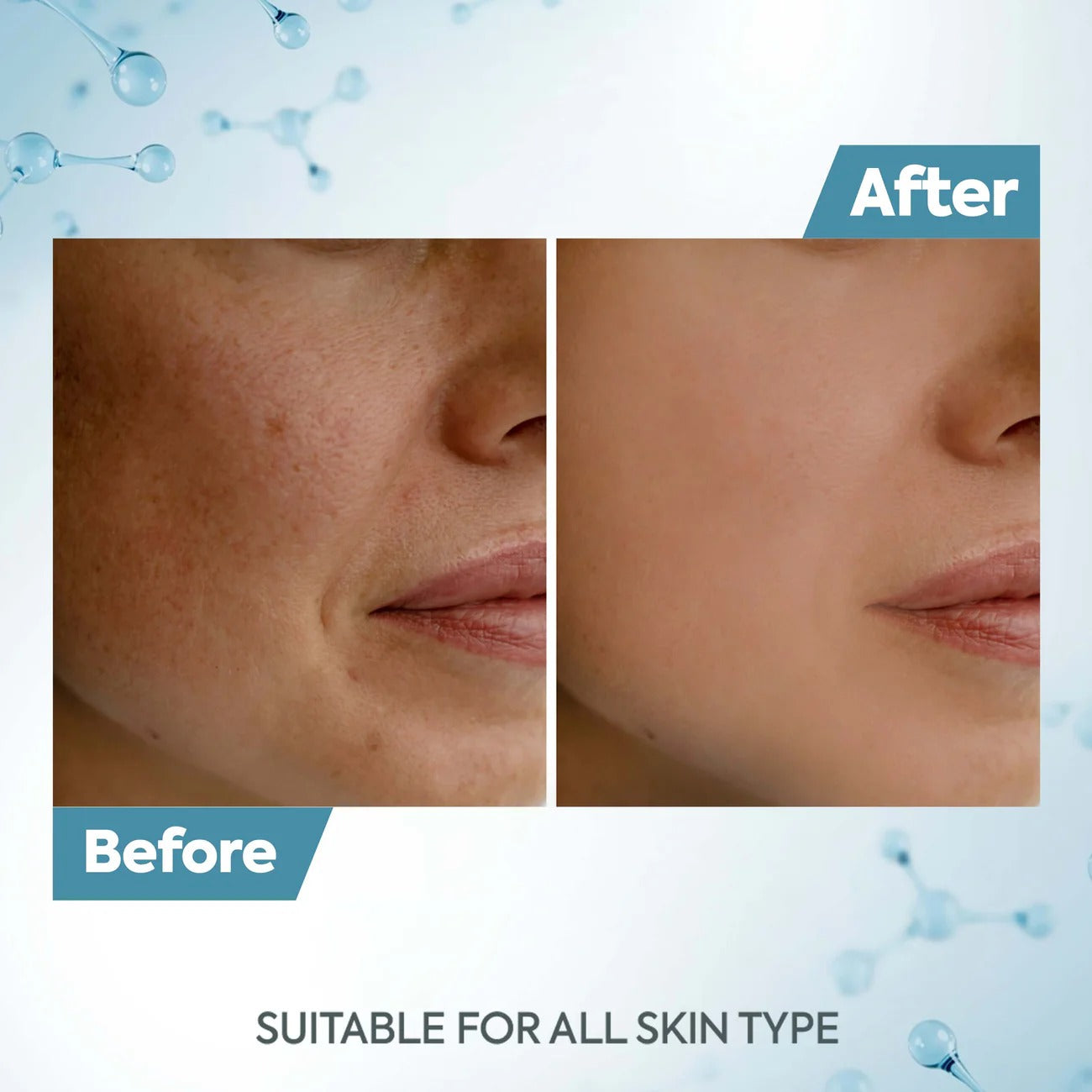 Raaga Professional De-Tan Pack | Face & Full Body Tan Removal Cream – 72g